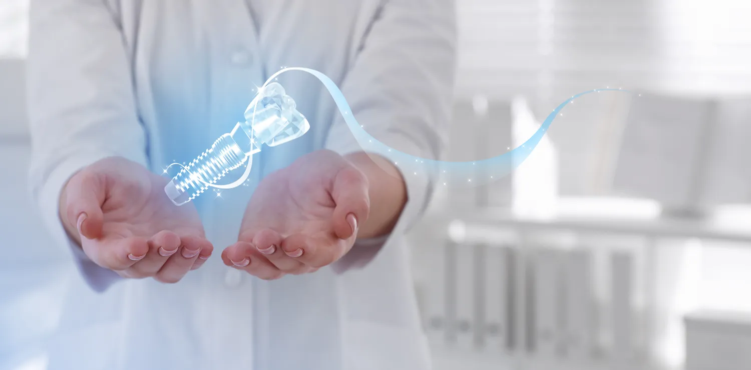 Implanty zębowe – co i jak?