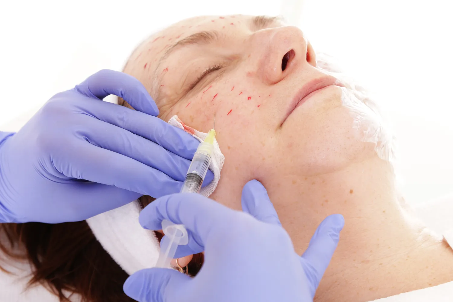 Medycyna estetyczna jaki VAT?