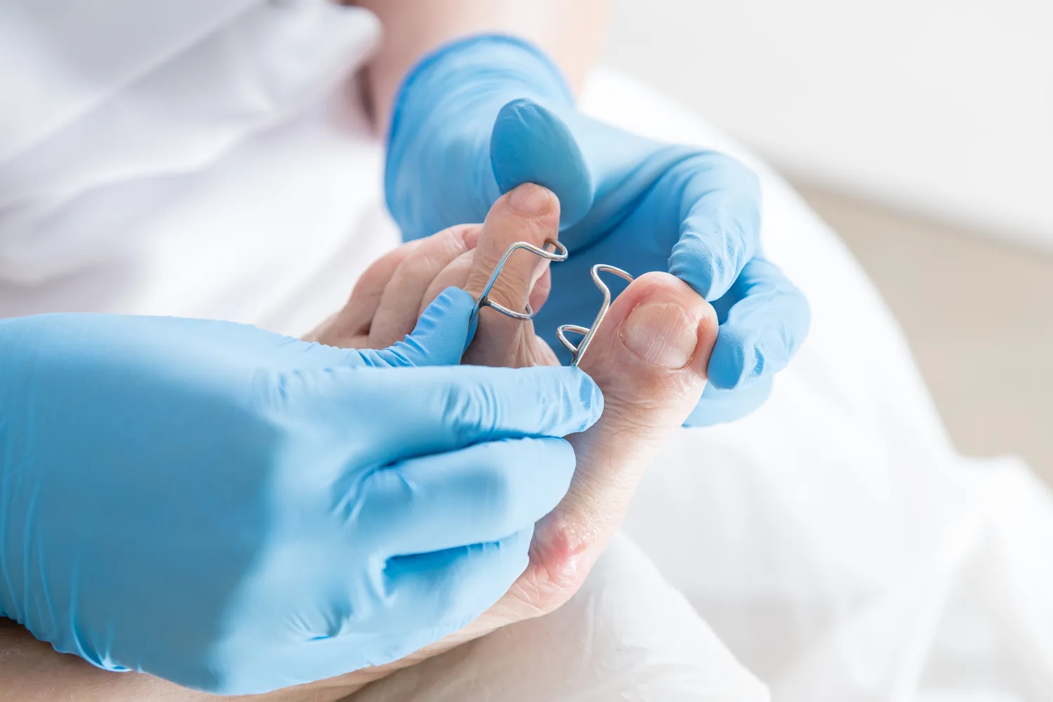 Czy zabiegi podologiczne to już konieczność?