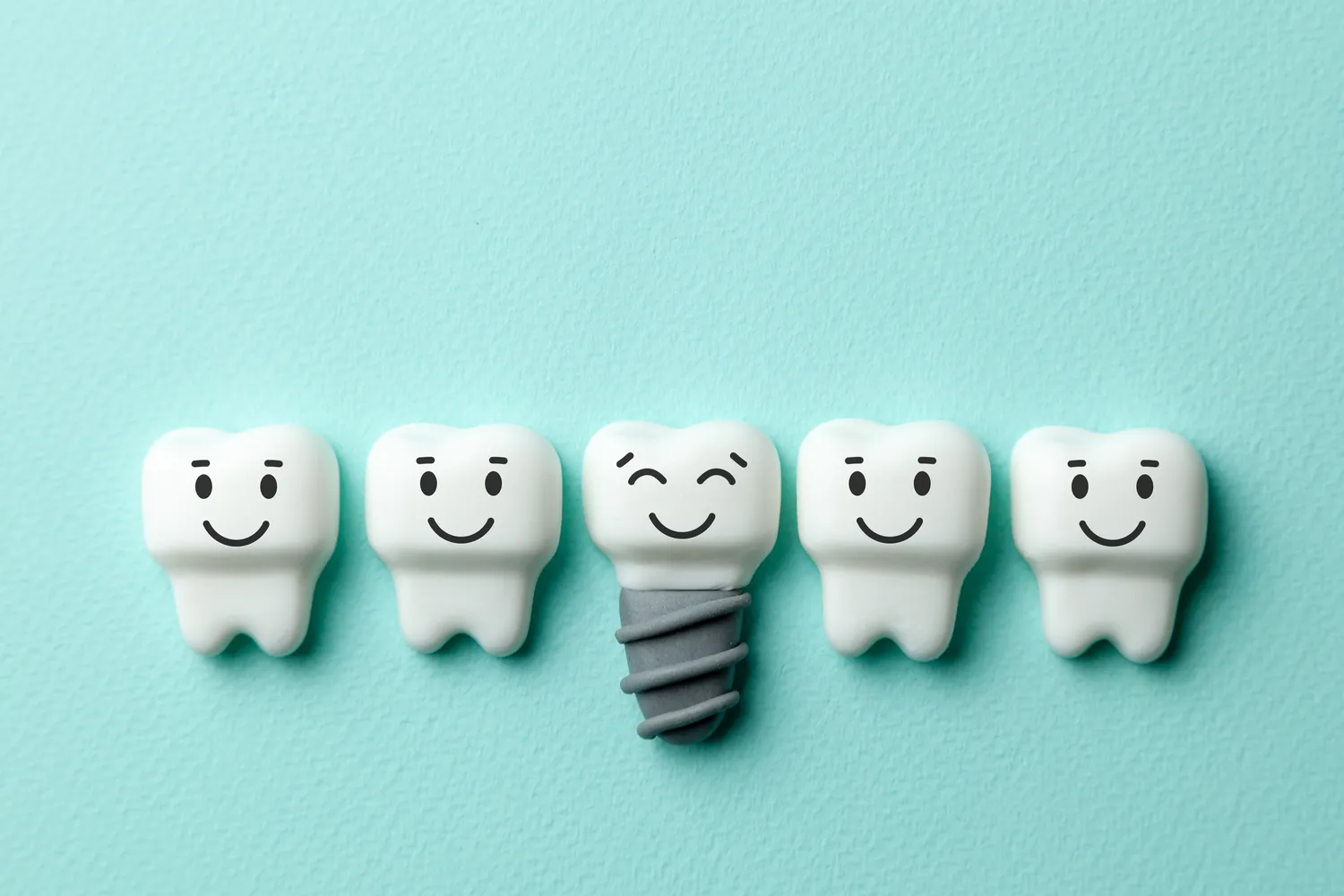 Implanty zębowe – proces zakładania implantu zębowego