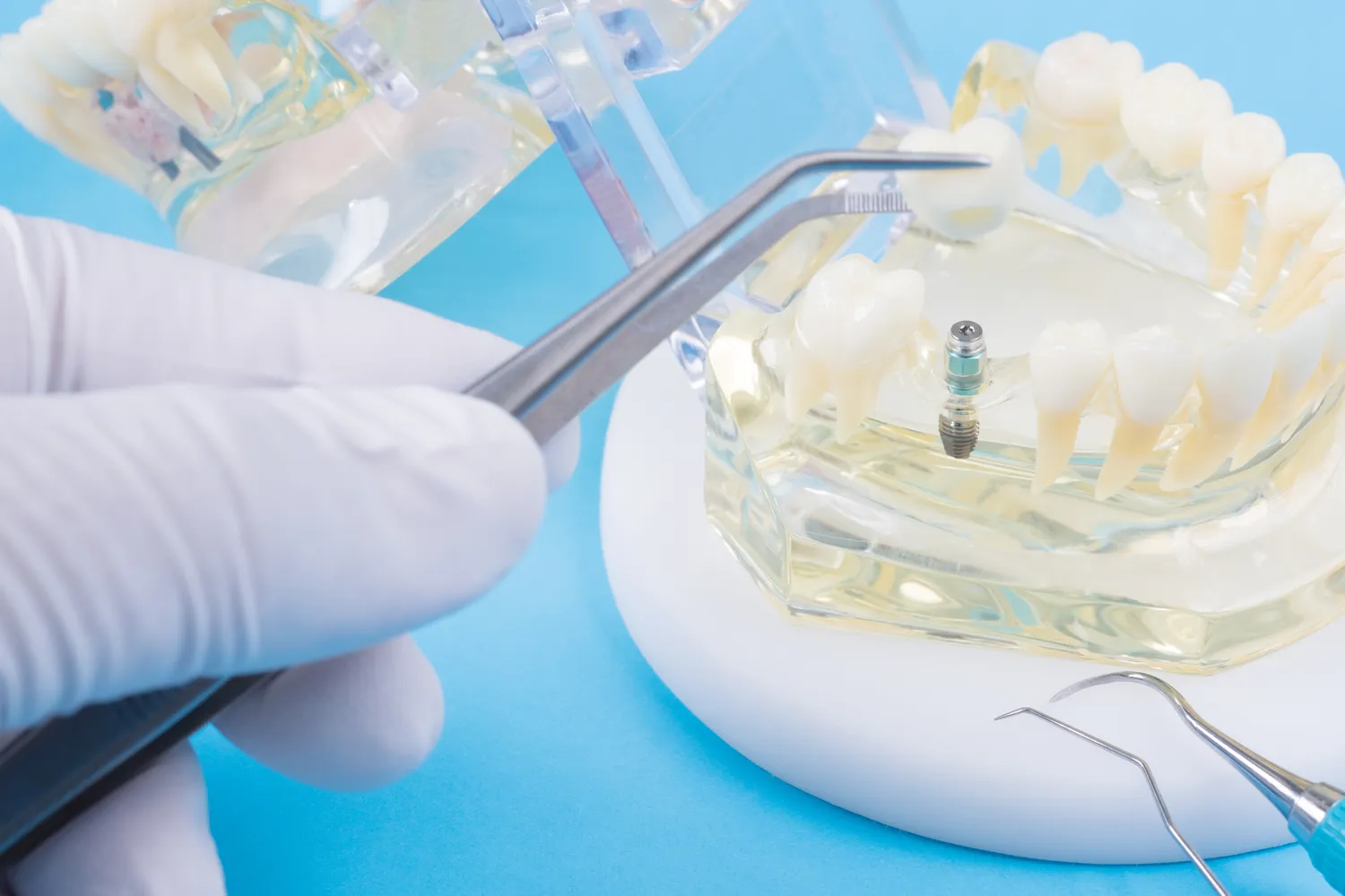 Najlepsza endodoncja Szczecin