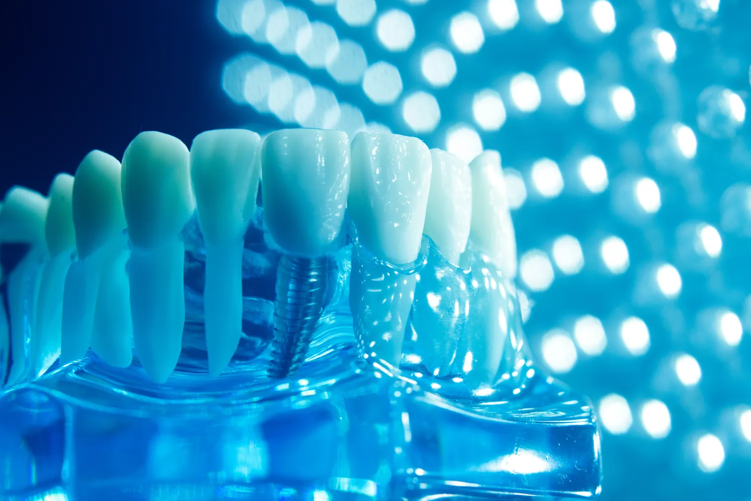 Leczenie kanałowe pod mikroskopem Szczecin